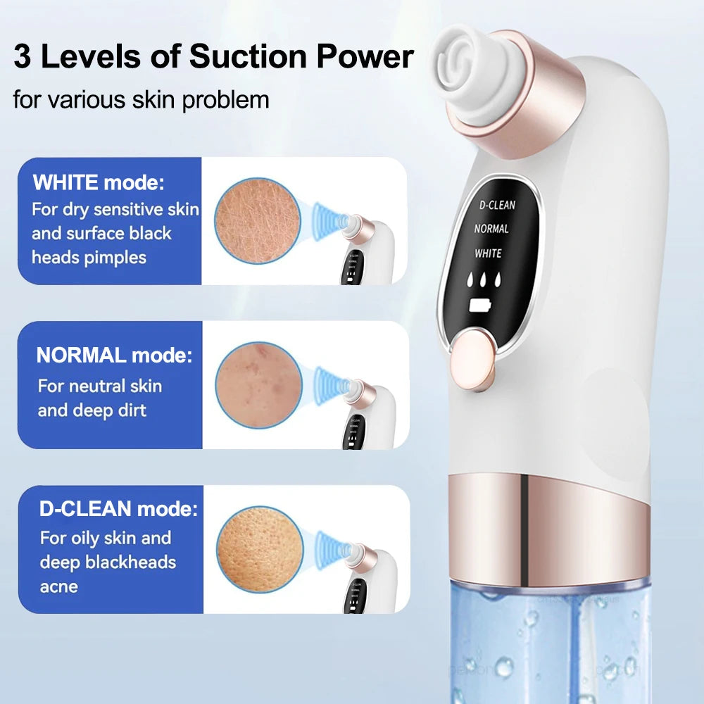 Blackhead Remover Vacuum – Deep Pore Facial Cleanser