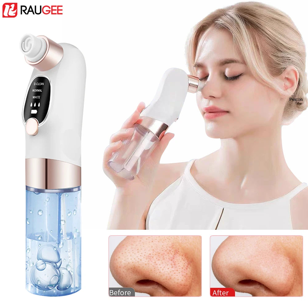Blackhead Remover Vacuum – Deep Pore Facial Cleanser