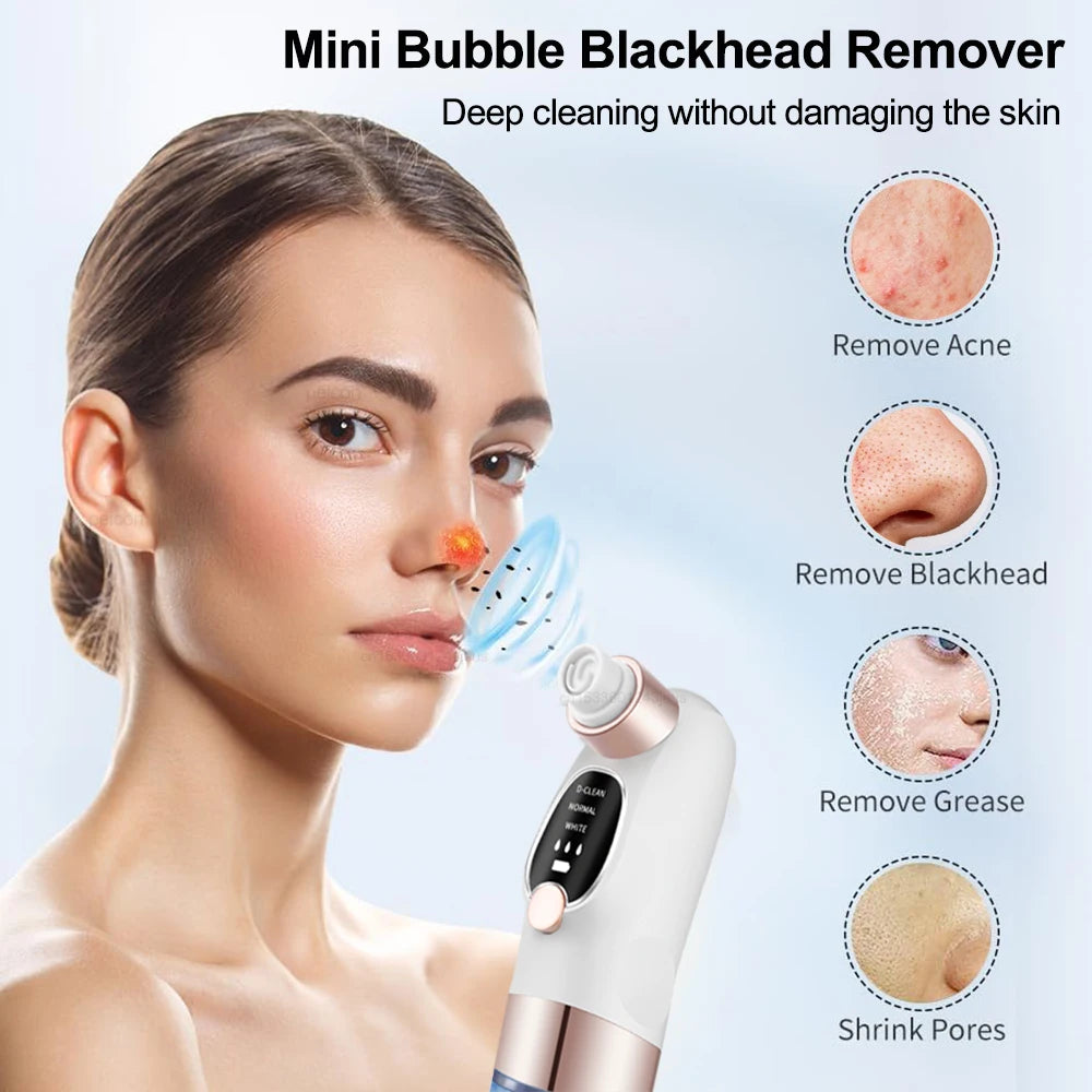 Blackhead Remover Vacuum – Deep Pore Facial Cleanser