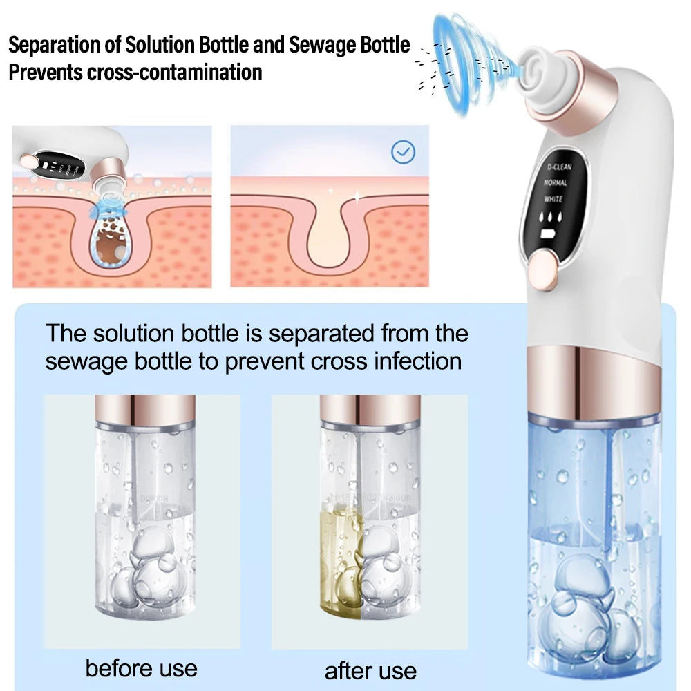 Blackhead Remover Vacuum – Deep Pore Facial Cleanser